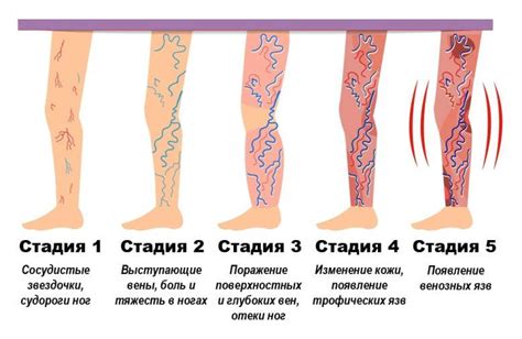 Как избежать появления привкуса металла после укола