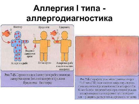 Никель: источник аллергических реакций