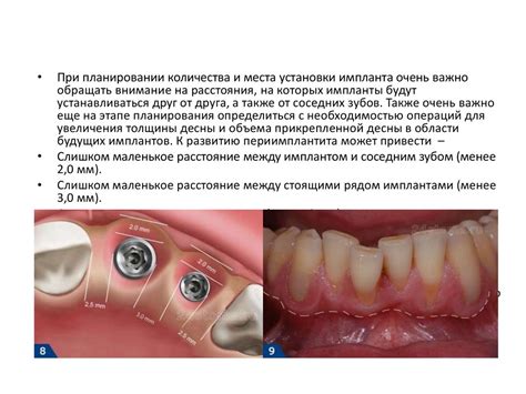  Механические методы устранения риска в основном металле