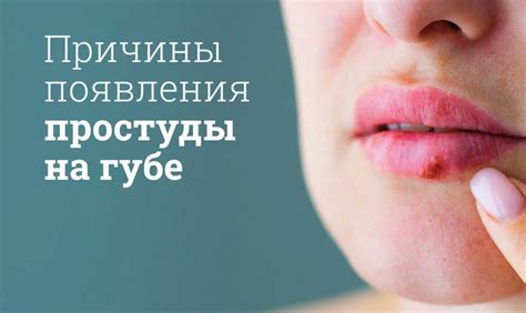 Альтернативные методы лечения простуды на губе