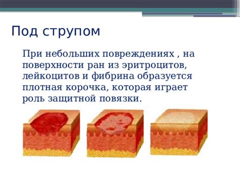 Альтернативные способы улучшения состояния при язвенном повреждении под слоем фибрина