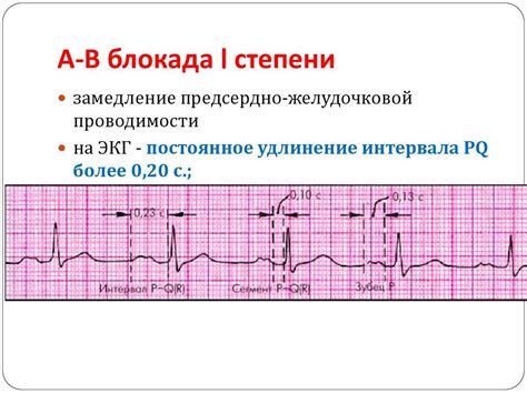 Блокада на ЭКГ у ребенка: общая информация