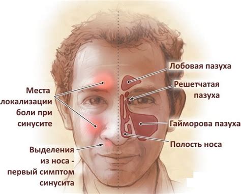 Блокада носовых пазух