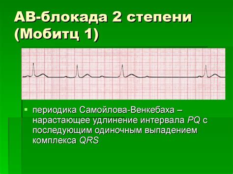 Блокада 2 степени: общая информация