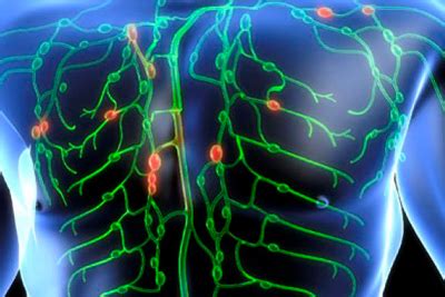 Болезни лимфатической системы