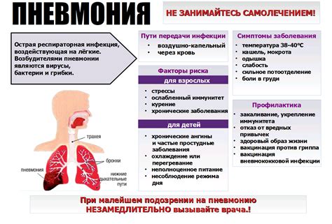 Важные рекомендации врачей при применении Левинокса для лечения пневмонии