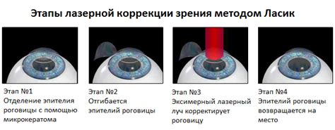 Виды обезболивания, используемые во время процедуры лазерной коррекции зрения