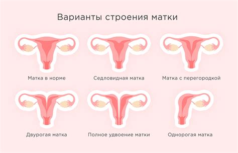 Влияние изменения освещенности внутри матки на формирование ребенка