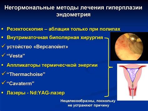 Влияние массажа на гиперплазию эндометрия