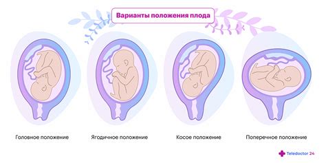 Влияние освещения на состояние сна и активности плода в материнской матке