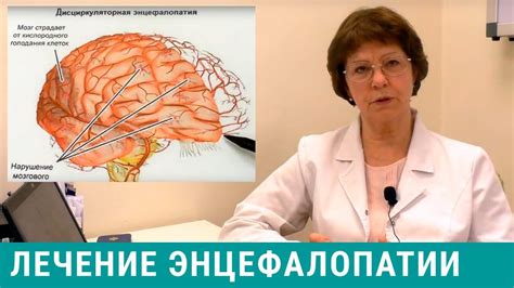 Влияние энцефалопатии головного мозга на процесс родов