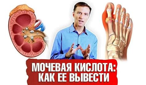 Воздействие на уровень мочевой кислоты