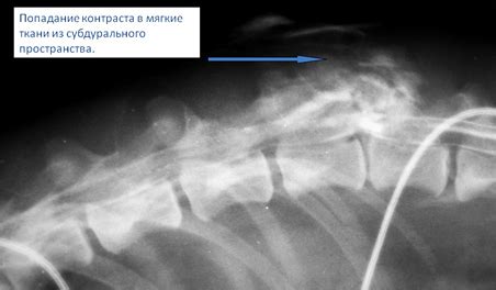 Восстановление подвижности после повреждения спинного мозга у собаки