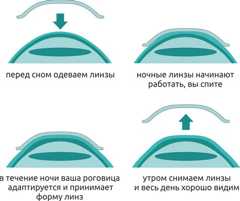 Выбор оптимального вида линз