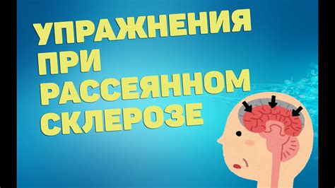 Выбор подходящего успокоительного при рассеянном склерозе