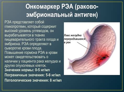 Высокий уровень углеводов