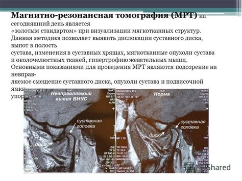 Выявление повреждения в хрящах сустава: важнейшие методы диагностики