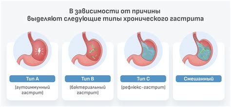 Гастрит в хронической форме