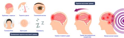 Головные травмы как причина изменения формы головы