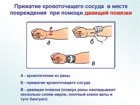 Дальнейшие действия после первичной помощи при разрыве кровеносного сосуда в области верхнего века