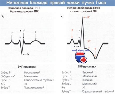 Диагностика ПНПГ у взрослых