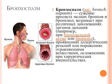 Диагностика бронхоспазма