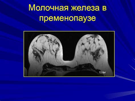 Диагностика гиперинтенсивного очага на Т2 ви