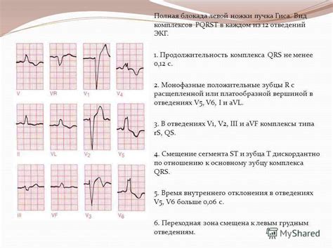 Диагностика и лечение блокады на ЭКГ у детей