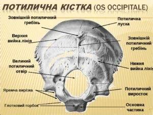 Диагностика и лечение узкой затылочной кости