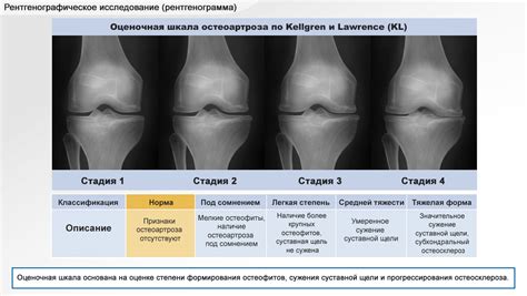 Диагностика коленного сустава