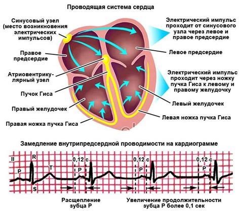 Диагностика нарушения желудочковой проводимости сердца