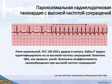 Диагностика нарушения проводимости