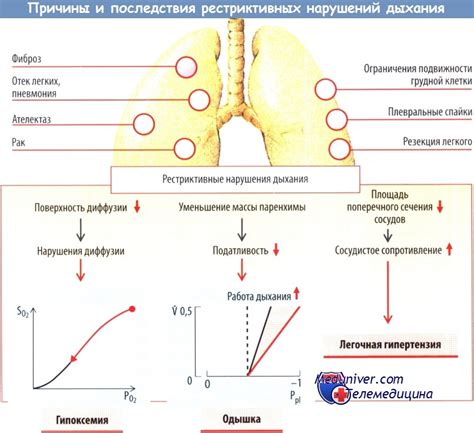 Диагностика рестриктивных нарушений