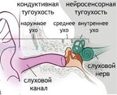 Диагностика тугоухости: основные методы