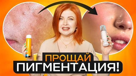 Домашние средства для борьбы с пигментацией