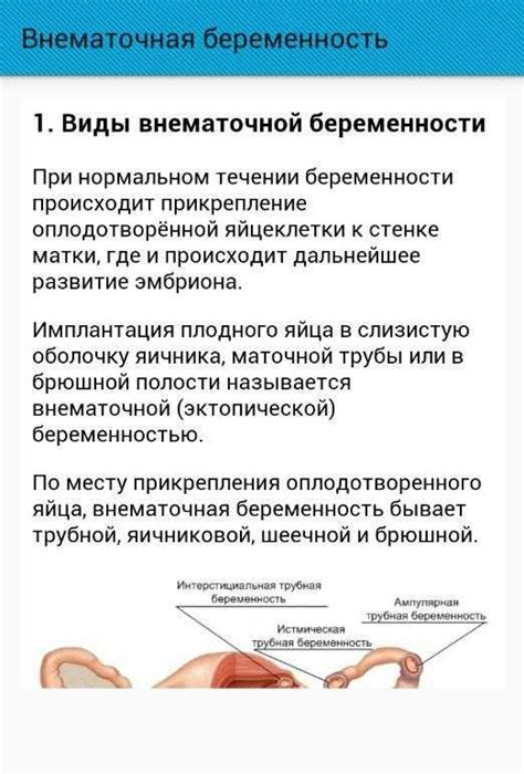 Другие признаки внематочной беременности, которые следует учитывать