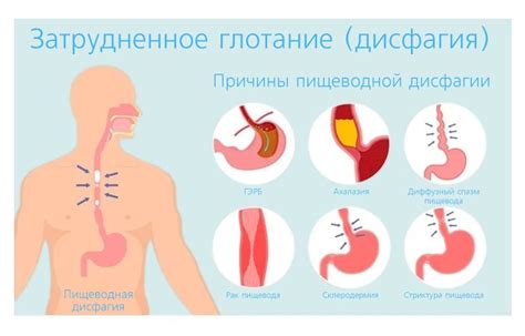 Затрудненное глотание пищи