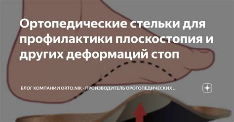 Значение ношения ортопедических стелек для профилактики плоскостопия