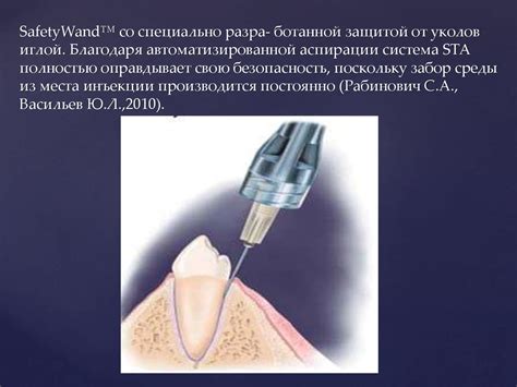 Инновационные методы обезболивания в советской стоматологии