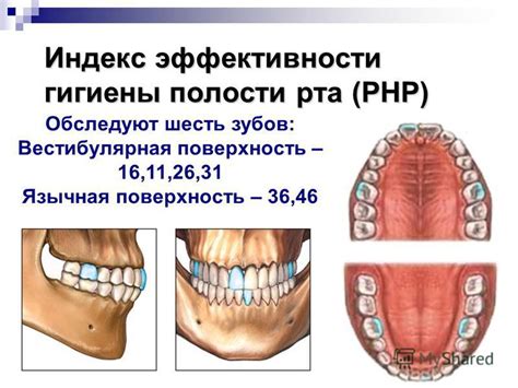 Интерпретация кривого рта