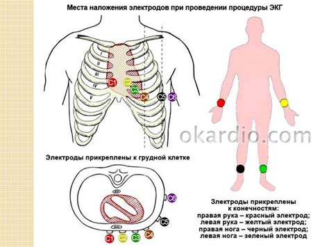 Использование специальных адаптеров и электродов для маленьких пациентов