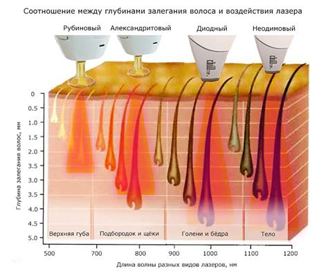 Исследования о воздействии лазерной эпиляции на фертильность