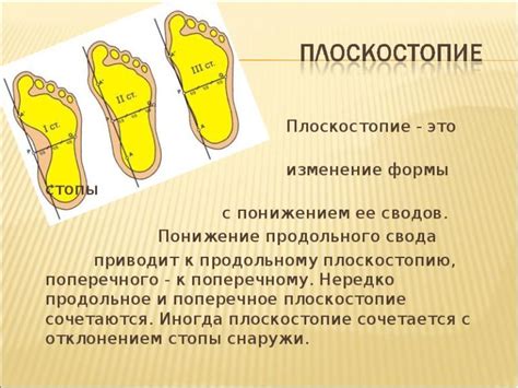 Исследования о связи между велосипедом и плоскостопием