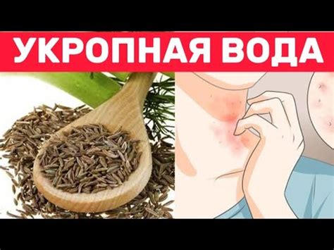 Исторический обзор и особенности укропной воды