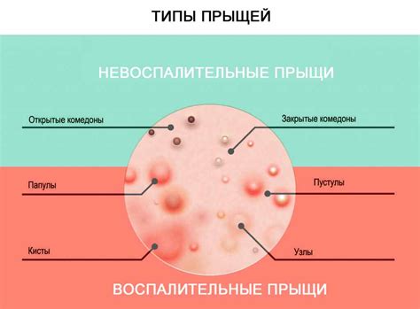 Какие места могут быть укушены