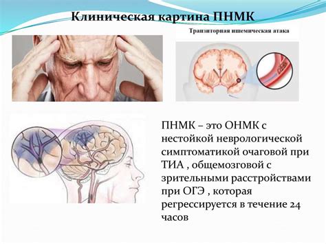 Какие симптомы возникают при нарушении контура QRS-T