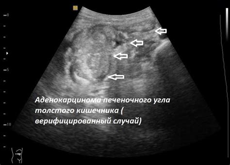 Как выглядят различные образования на уЗИ