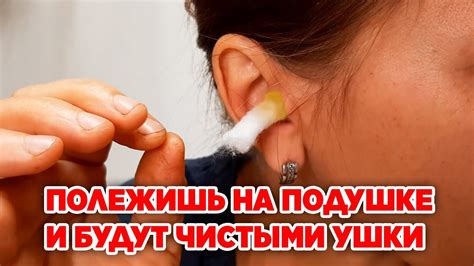 Как избавиться от сухой серы