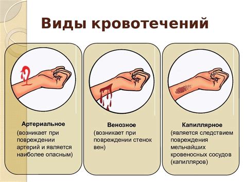 Как определить источник кровотечения