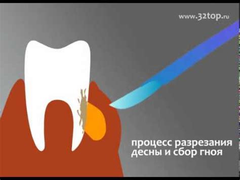 Как предотвратить появление флюса изнутри